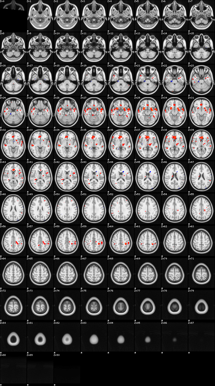 ../../../../_images/00-FgtC2.png